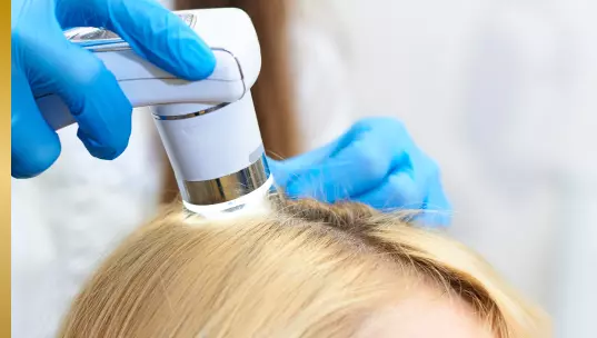 Inspection des cheveux pour l’alopécie féminine